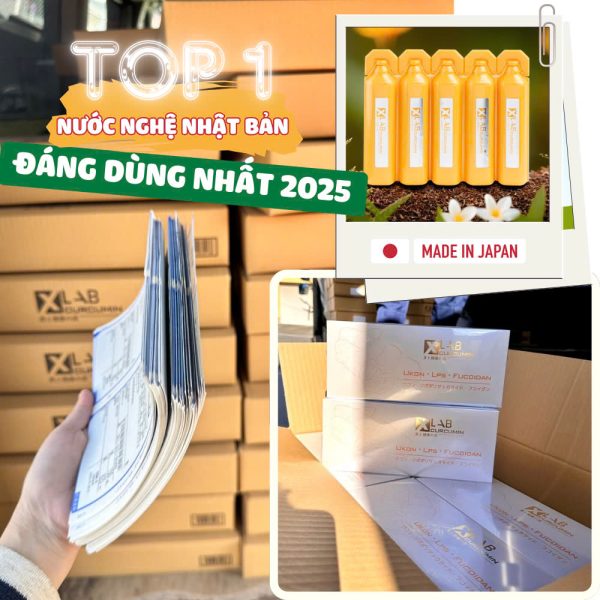 Nghệ Xlab CHUẨN TOP 1 NGHỆ ĐÁNG DÙNG NHẤT 2025