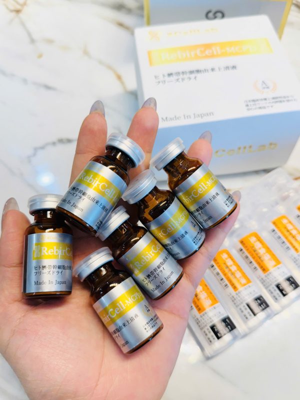 Truyền tế bào gốc cuống rốn nguyên gốc